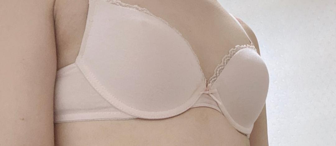 Phẫu thuật nâng ngực Hàn Quốc | Very Good Plastic Surgery kết nối trực tiếp ga Gangnam | Thẩm mỹ nâng ngực chú trọng an toàn với bác sĩ chuyên khoa thường trực