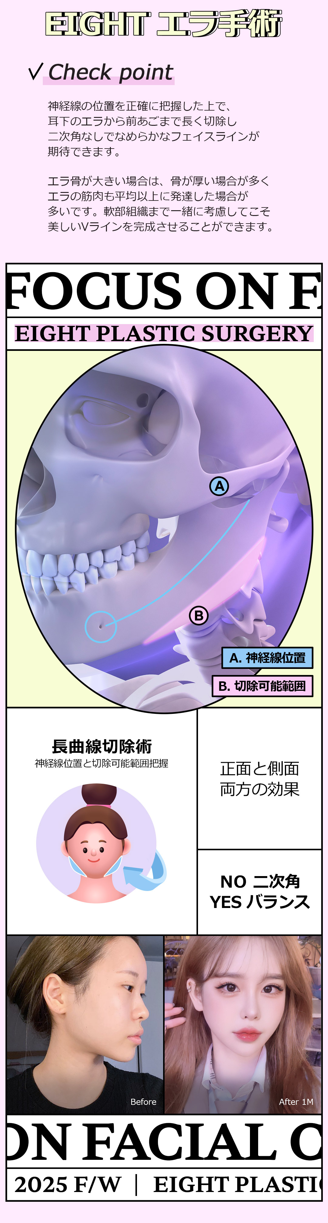 Bộ 3 điểm đường viền Eight Thẩm mỹ Hàn Quốc｜Tạo hình gò má, hàm, cằm hướng đến đường viền V-line｜Ga Apgujeong