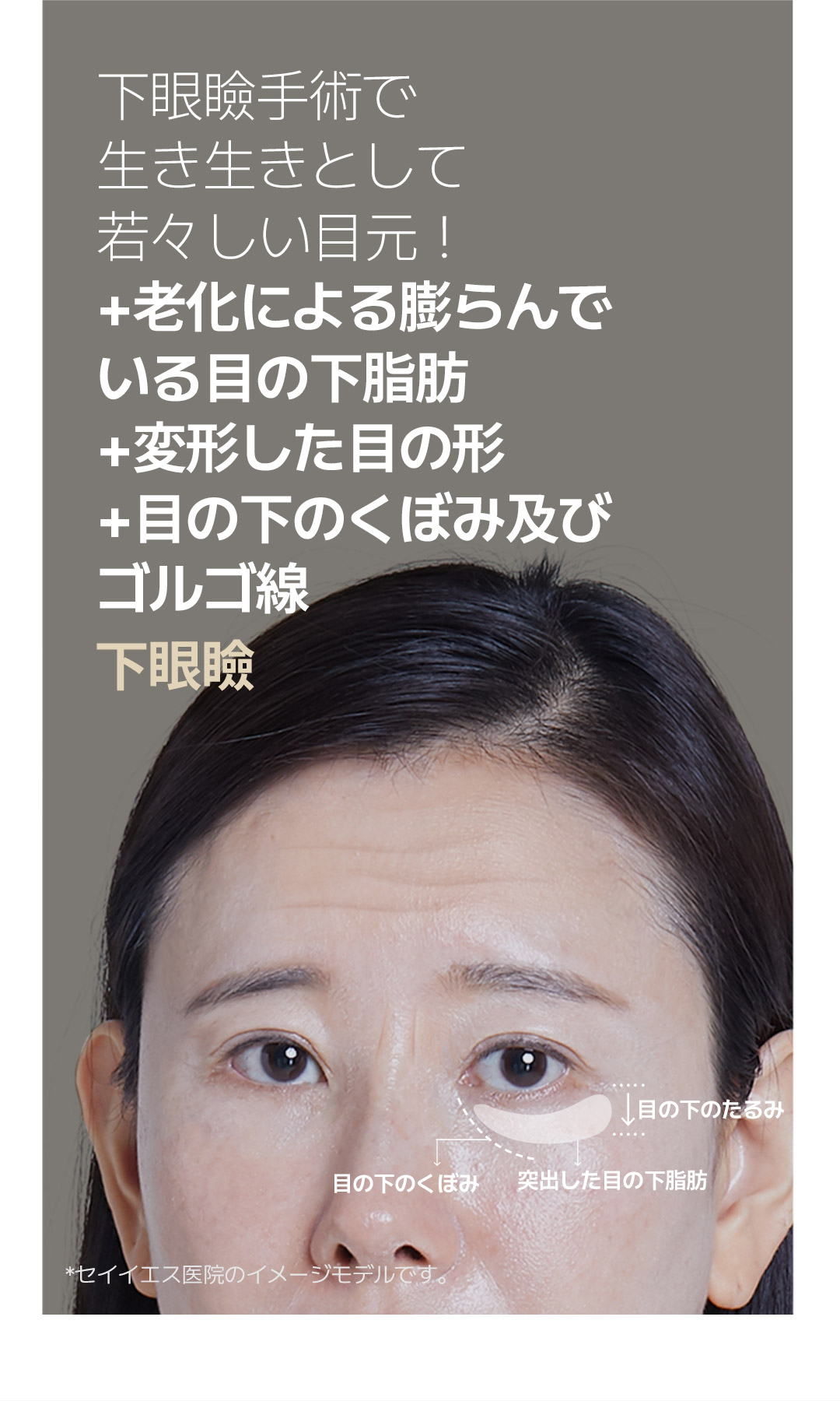 Hướng tới cải thiện chảy xệ・phồng mỡ vùng mắt với Phẫu thuật tạo hình mí dưới | Seoul Sinnonhyeon stn.・Phòng khám Sayyes