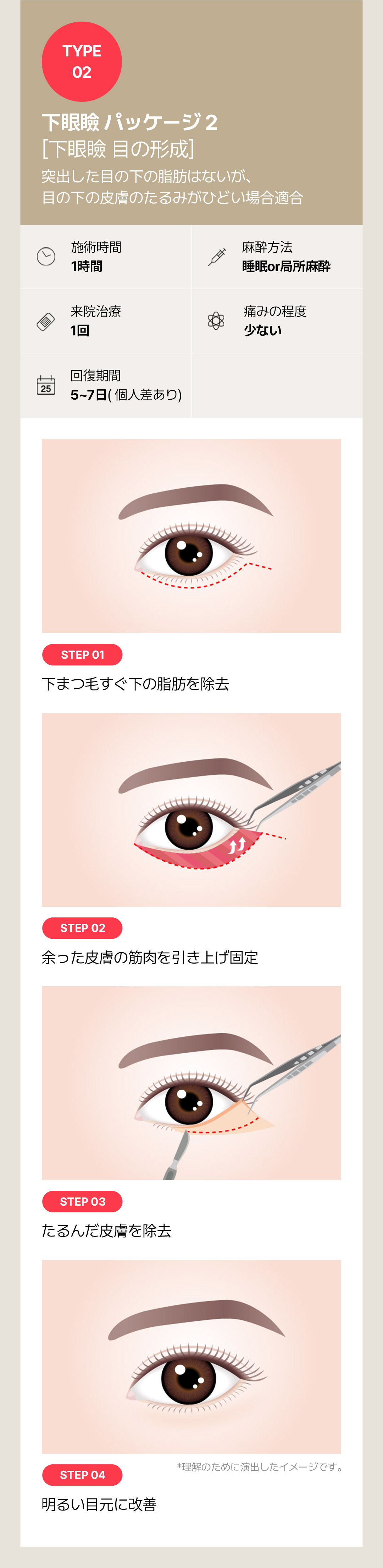 Hướng tới cải thiện chảy xệ・phồng mỡ vùng mắt với Phẫu thuật tạo hình mí dưới | Seoul Sinnonhyeon stn.・Phòng khám Sayyes