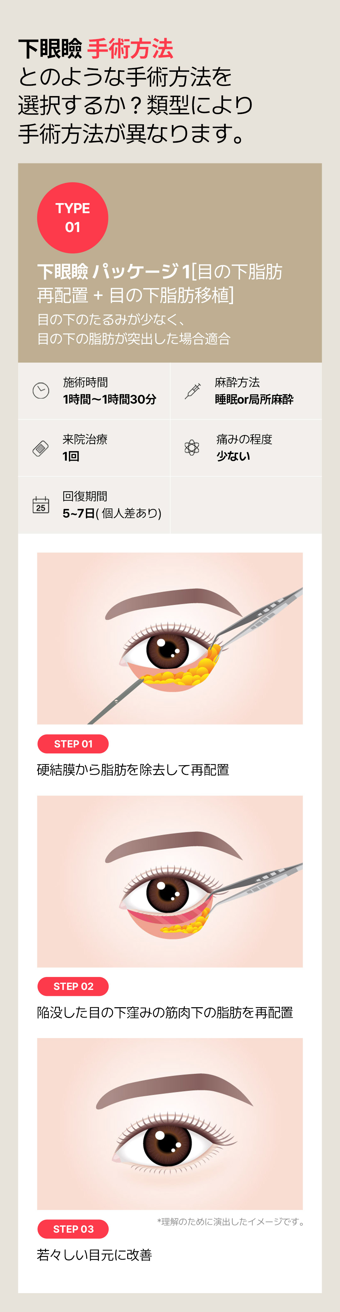 Hướng tới cải thiện chảy xệ・phồng mỡ vùng mắt với Phẫu thuật tạo hình mí dưới | Seoul Sinnonhyeon stn.・Phòng khám Sayyes