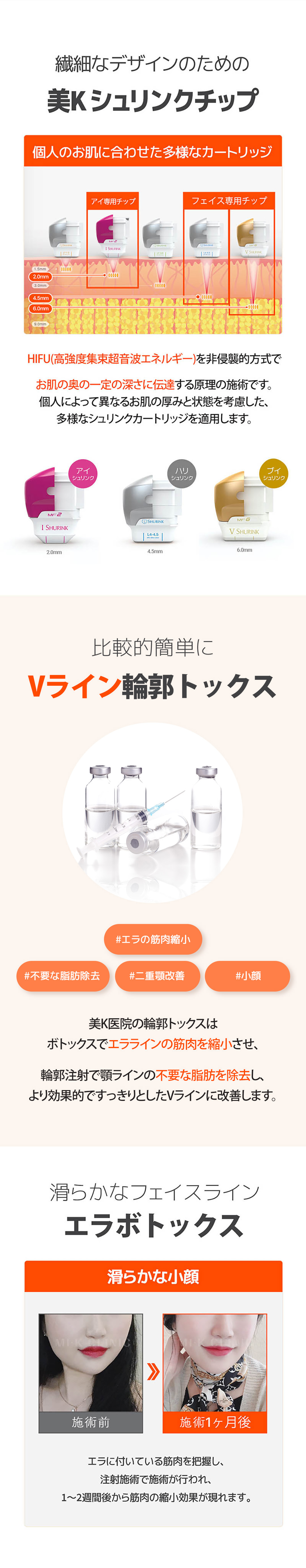 Shrink 400 shot + Contour Tox chăm sóc V-line mặt nhỏ | Phòng khám MiK Seoul ga Gangnam