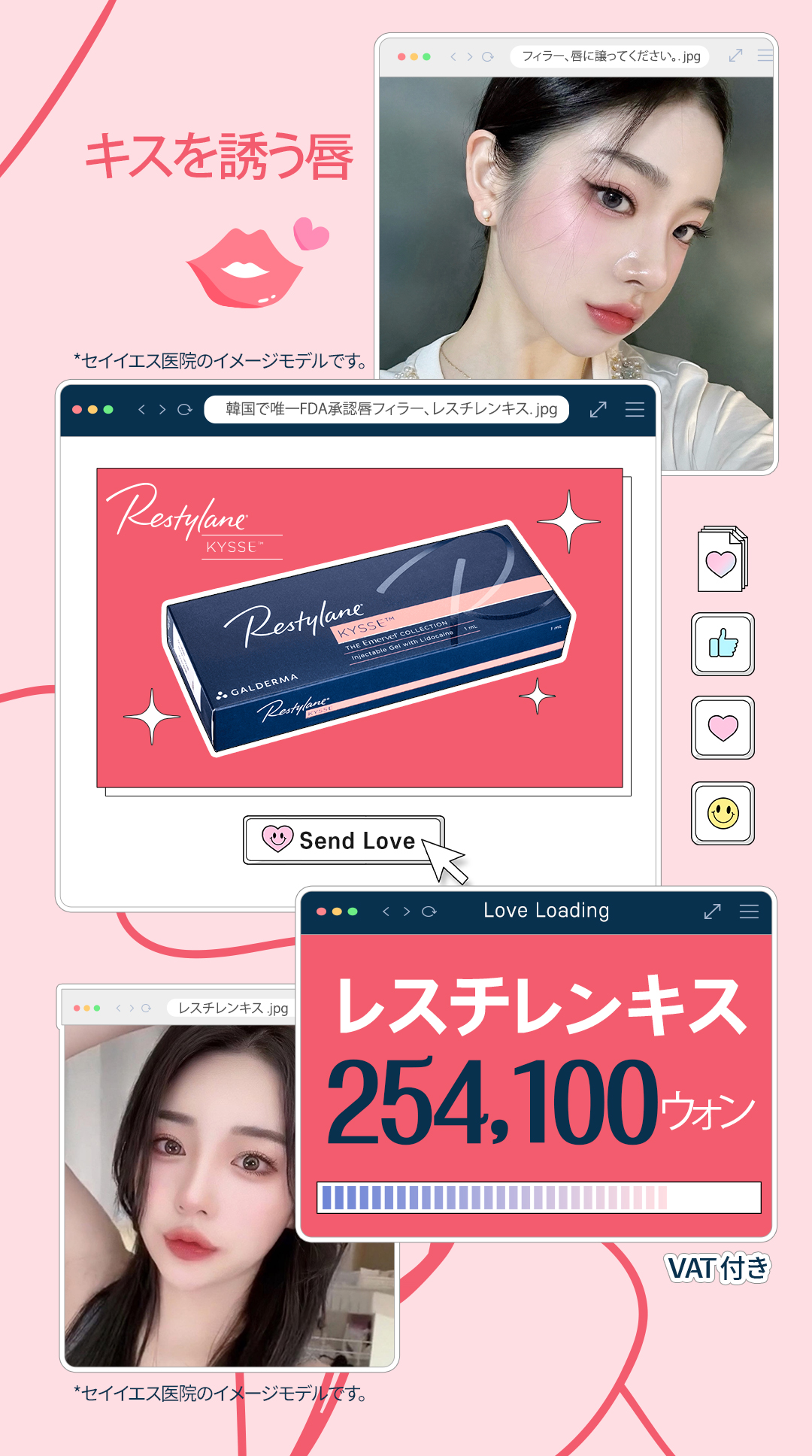 Filler môi Restylane Kysse | Hướng đến tăng volume tự nhiên với filler chuyên dụng cho môi được FDA phê duyệt | Say Yes Phòng khám Seoul