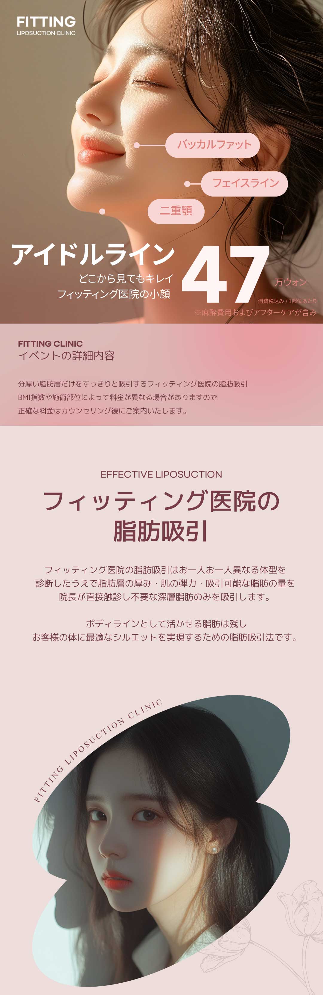 Hút mỡ mặt tạo mặt nhỏ gọn gàng | Cải thiện mỡ buccal và nọng cằm | Fitting Sinsa Seoul