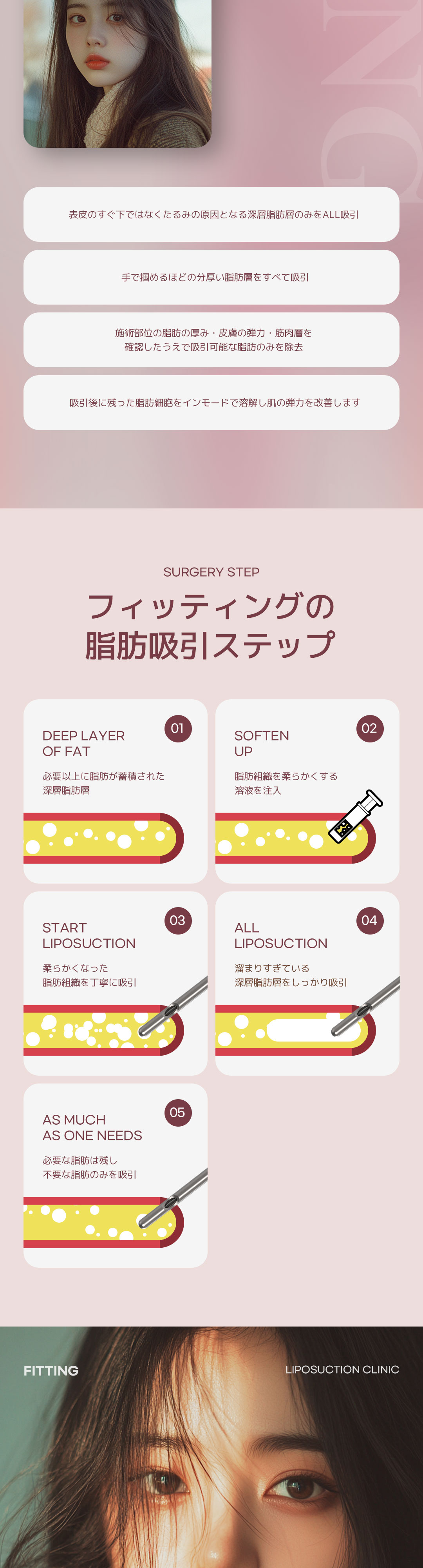 Hút mỡ mặt tạo mặt nhỏ gọn gàng | Cải thiện mỡ buccal và nọng cằm | Fitting Sinsa Seoul