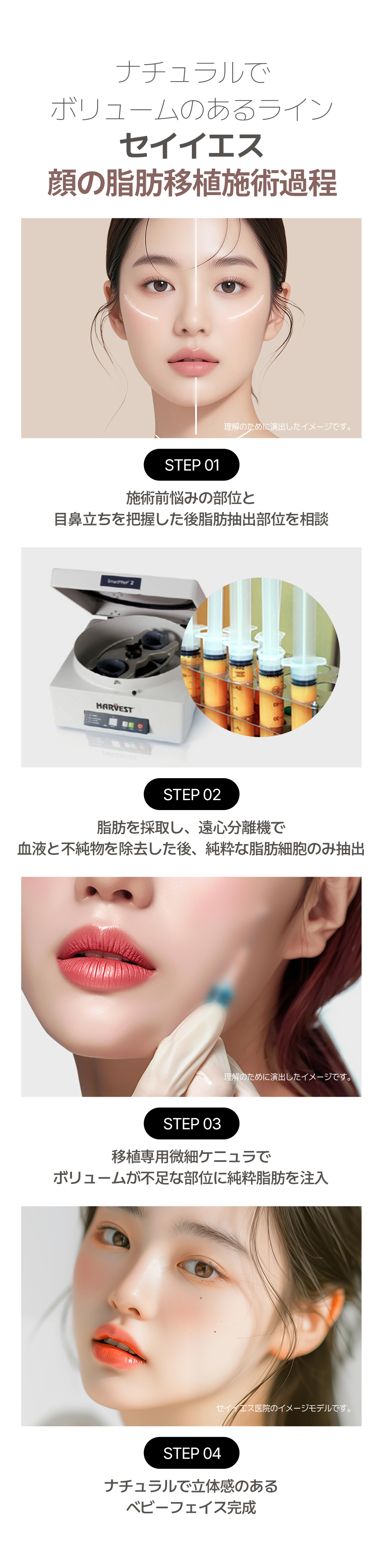 Cấy mỡ mặt Hàn Quốc | Hướng đến tăng độ phồng tự nhiên bằng mô tự thân | Say Yes Clinic Gangnam