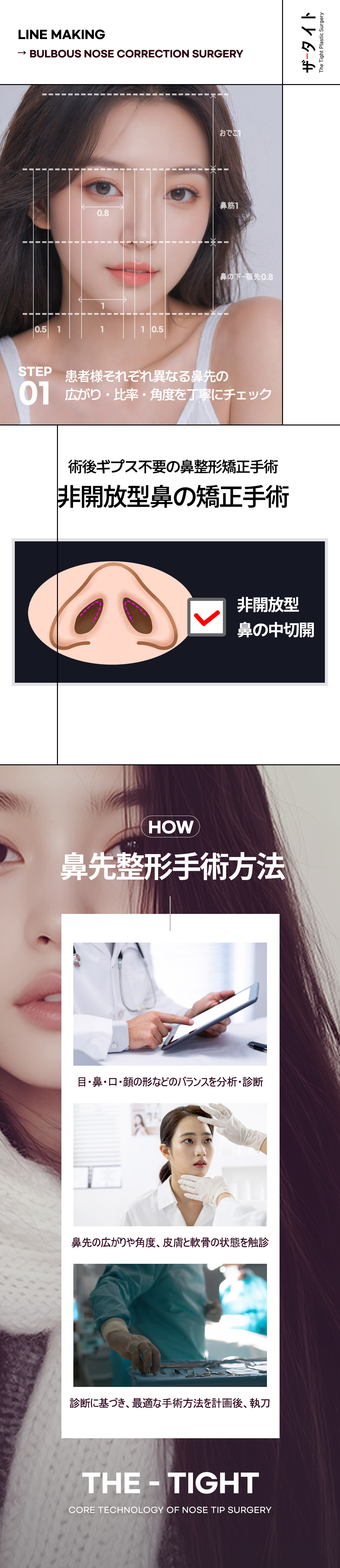 Phẫu thuật mũi củ tỏi không mở Hàn Quốc | Chỉnh đầu mũi sẹo khó thấy | The Tight Thẩm mỹ | Quận Gangnam Seoul