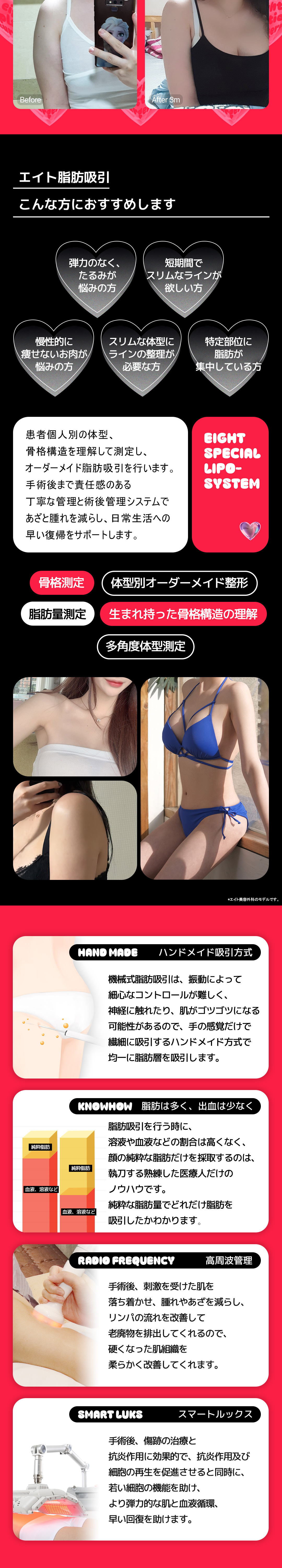 【Hút mỡ Hàn Quốc】Cải thiện đường viền cơ thể bụng・bắp tay・đùi｜Eight Plastic Surgery｜Ngay ga Apgujeong