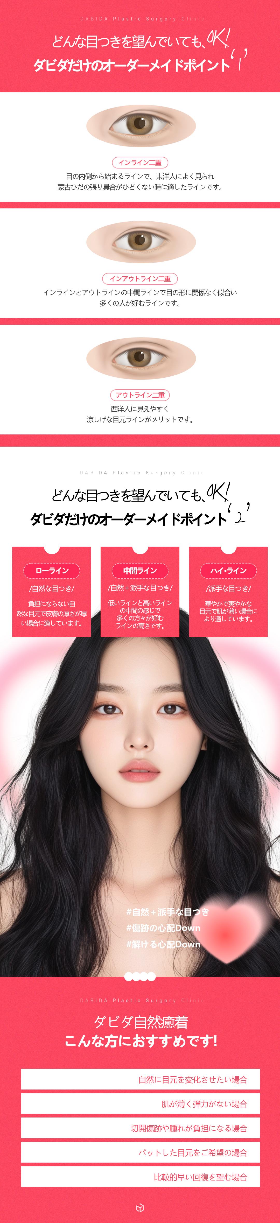 Phẫu thuật tạo mí đôi dính tự nhiên | Hướng tới kết quả tự nhiên với phương pháp cố định 10 ĐIỂM | Phòng khám Davida Thẩm mỹ