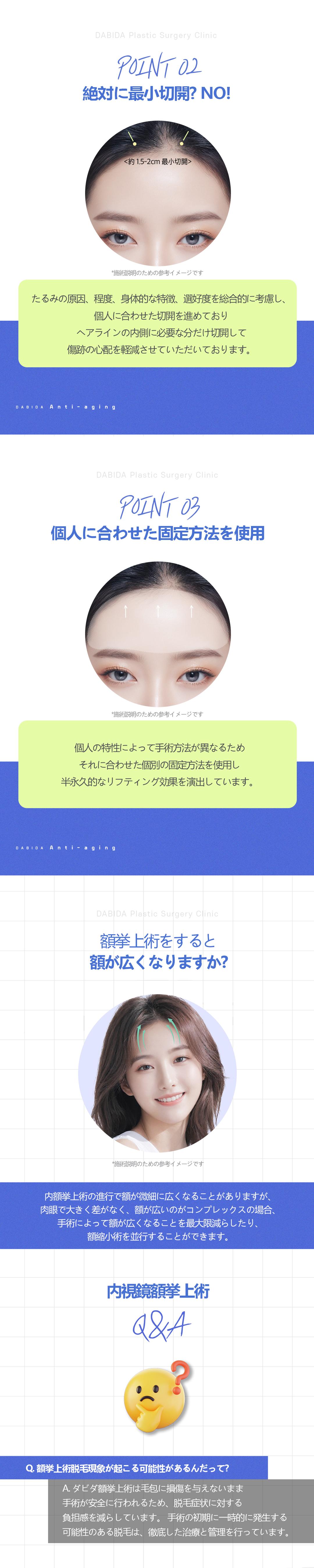 Phòng khám Thẩm mỹ Ngoại khoa Davida Hàn Quốc｜Nhắm đến trẻ hóa vùng trên mặt bằng phẫu thuật nâng trán nội soi｜Trong khoảng cách đi bộ từ ga Apgujeong