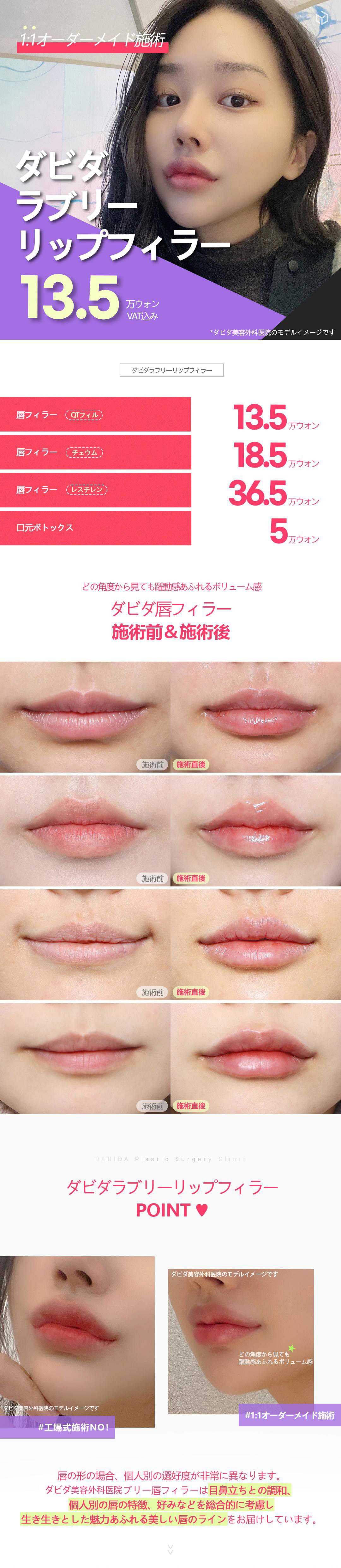 【Apgujeong】Điều trị filler môi Lovely Lip tùy chỉnh 1:1 | Hướng đến đường môi lý tưởng | Davida Thẩm mỹ viện