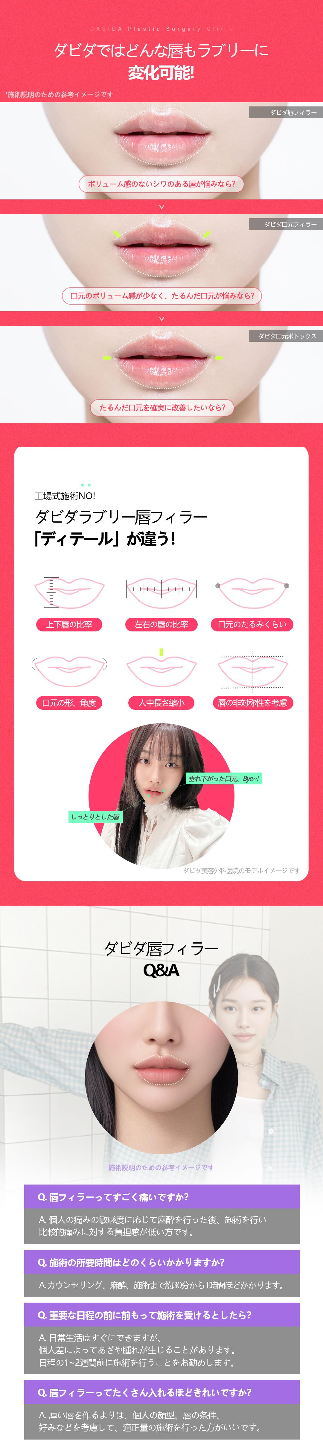 【Apgujeong】Điều trị filler môi Lovely Lip tùy chỉnh 1:1 | Hướng đến đường môi lý tưởng | Davida Thẩm mỹ viện