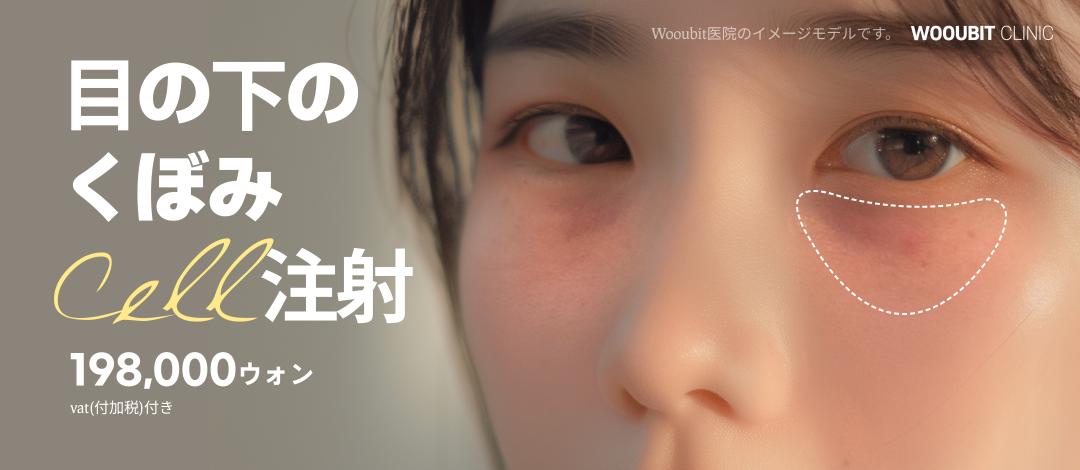 Cải thiện hõm dưới mắt | Tiêm Juvelook × Tế bào gốc máu tự thân | Phòng khám WOOUBIT Seoul Sinnonhyeon