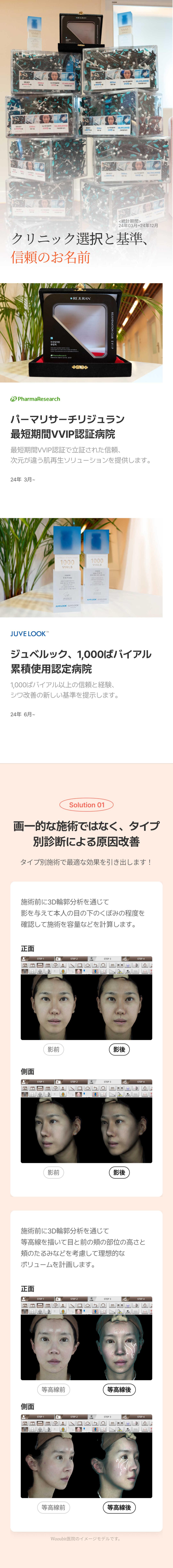 Cải thiện hõm dưới mắt | Tiêm Juvelook × Tế bào gốc máu tự thân | Phòng khám WOOUBIT Seoul Sinnonhyeon