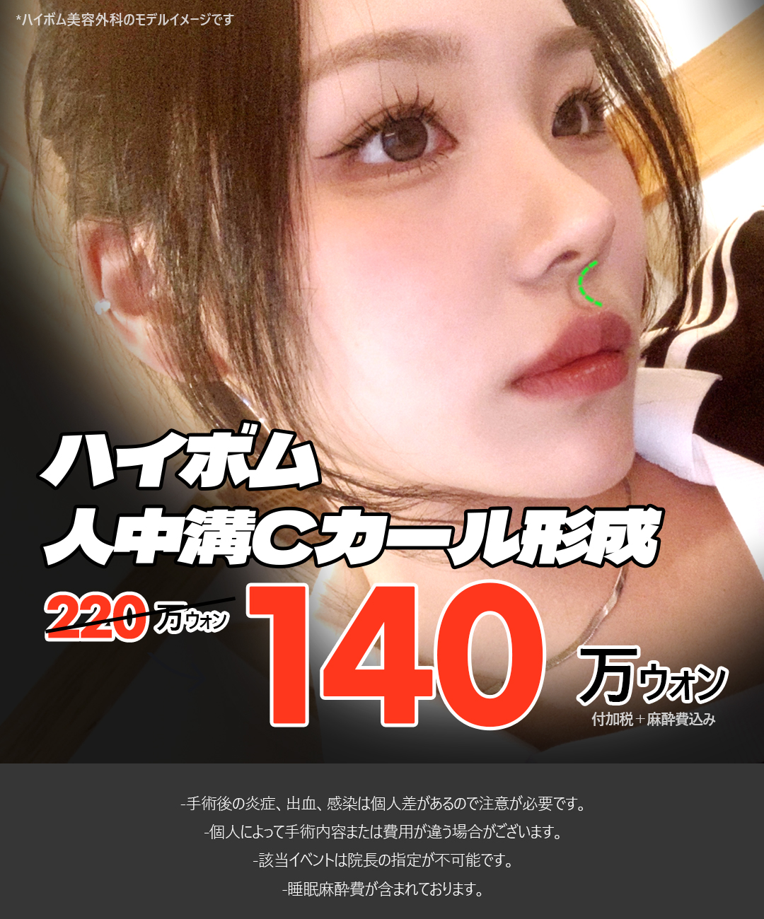 Đường môi tự nhiên với phẫu thuật tạo rãnh nhân trung C-curl | Liệu trình rạch trong miệng khó thấy sẹo | Haibeom Thẩm mỹ viện