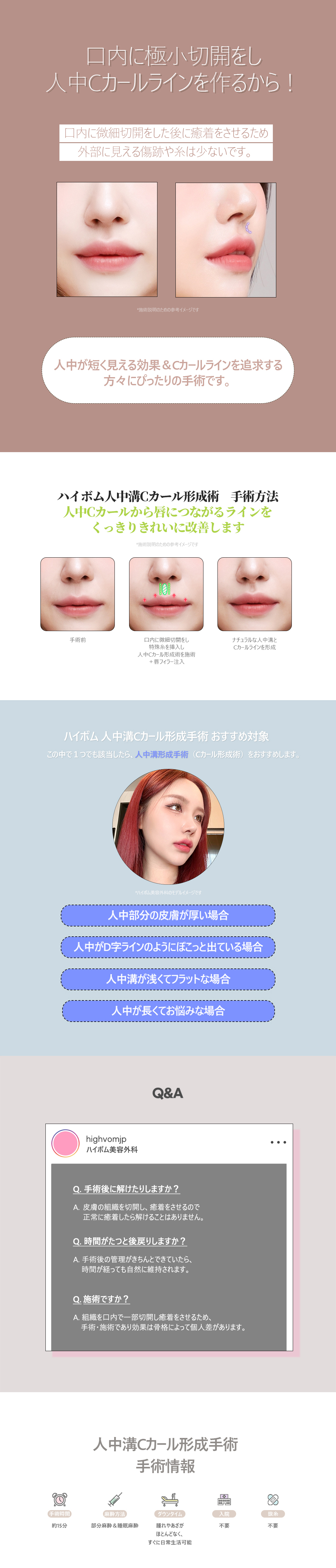 Đường môi tự nhiên với phẫu thuật tạo rãnh nhân trung C-curl | Liệu trình rạch trong miệng khó thấy sẹo | Haibeom Thẩm mỹ viện