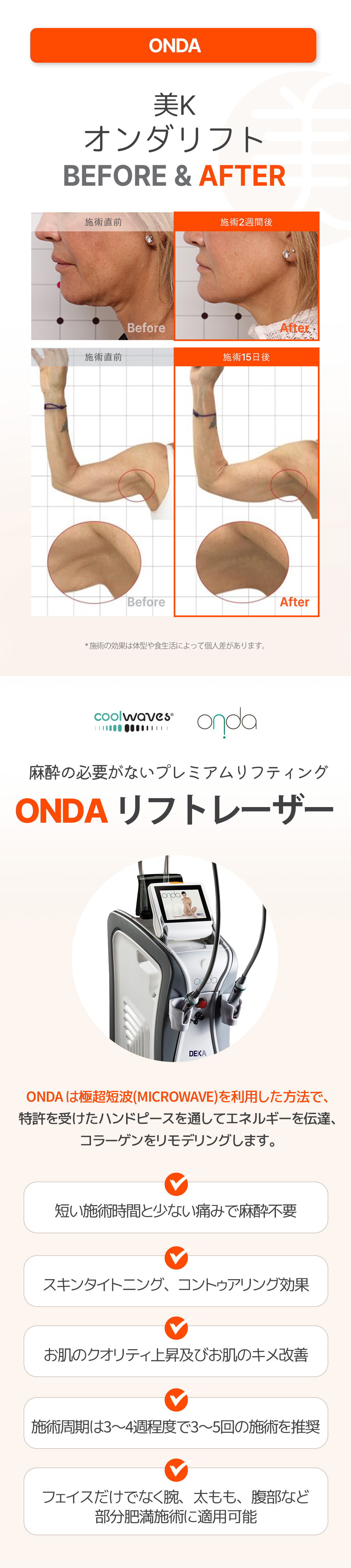 Liệu trình Onda Lift | Nâng và làm căng sóng vi ba không cần gây mê | Mikey Clinic ga Gangnam