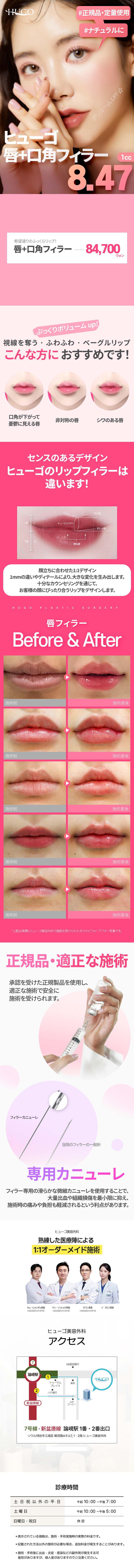 Filler môi và khóe miệng 1cc 9,170 yên | Hướng đến môi căng mọng | HUGO Thẩm mỹ viện | ga Nonhyeon Gangnam Seoul