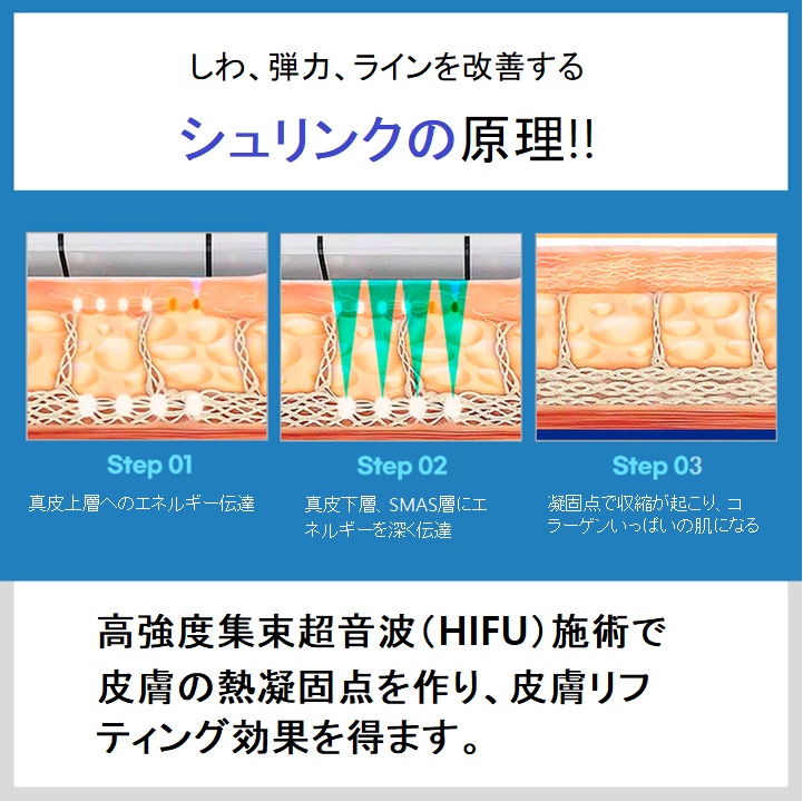 Shrink Lifting (HIFU) hướng đến độ căng da và nâng cơ | Yonsei Slimline Clinic cách ga Apgujeong 30 giây