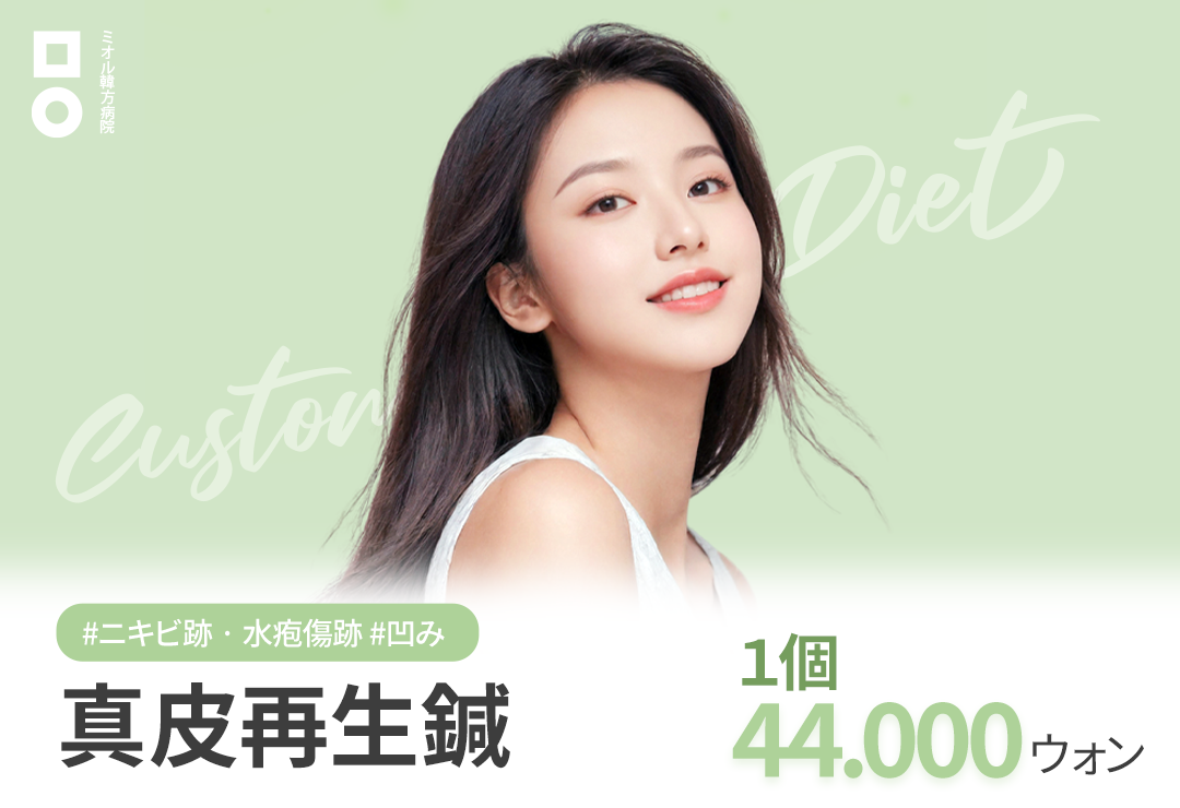 Châm cứu tái sinh hạ bì hướng đến cải thiện sẹo lõm do mụn và thủy đậu | Áp dụng kỹ thuật Flick | Miol Hàn phương Bệnh viện