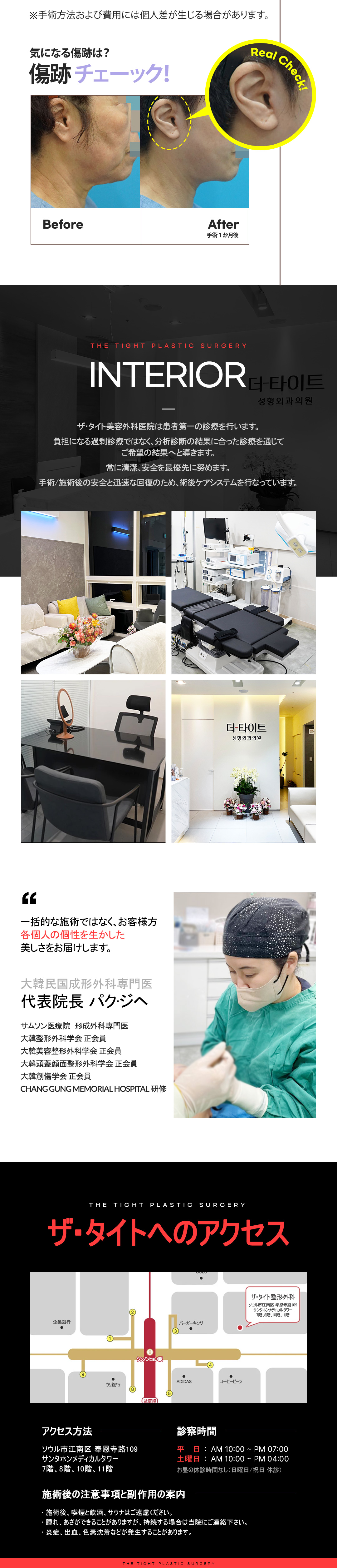 Hàn Quốc Gangnam The Tight Plastic Surgery Facelift・Nâng trán | Điều trị Top Lifting chọn theo từng vùng