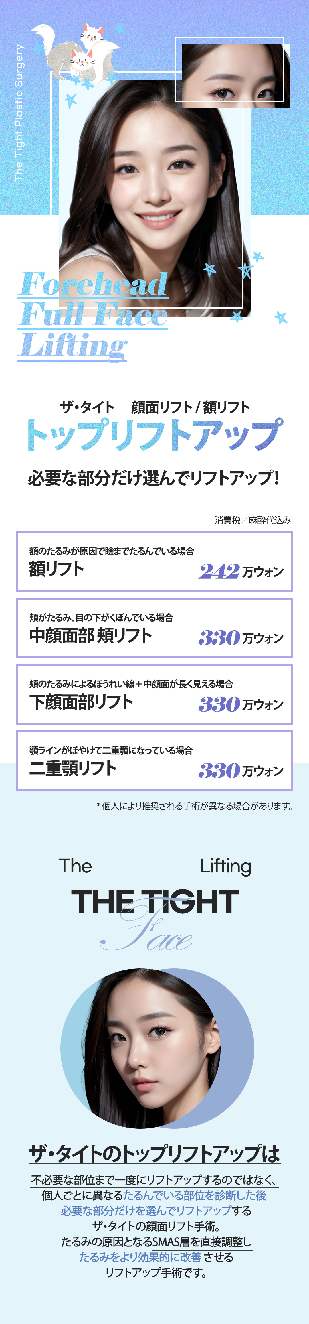 Hàn Quốc Gangnam The Tight Plastic Surgery Facelift・Nâng trán | Điều trị Top Lifting chọn theo từng vùng