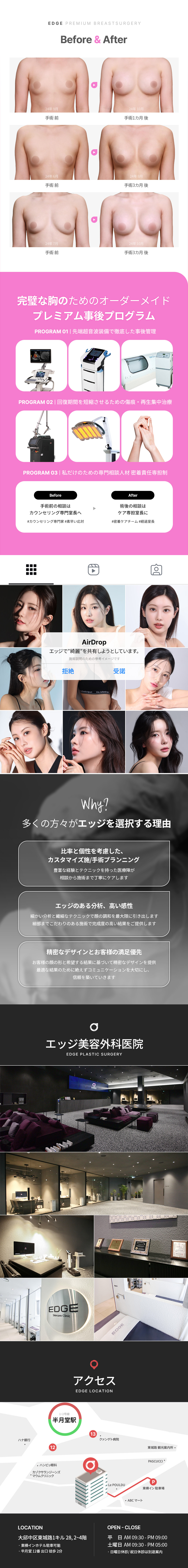 Phẫu thuật nâng ngực | Daegu Edge Plastic Surgery | Điều trị nâng ngực sử dụng Motiva・Mentor bởi bác sĩ chuyên khoa tạo hình