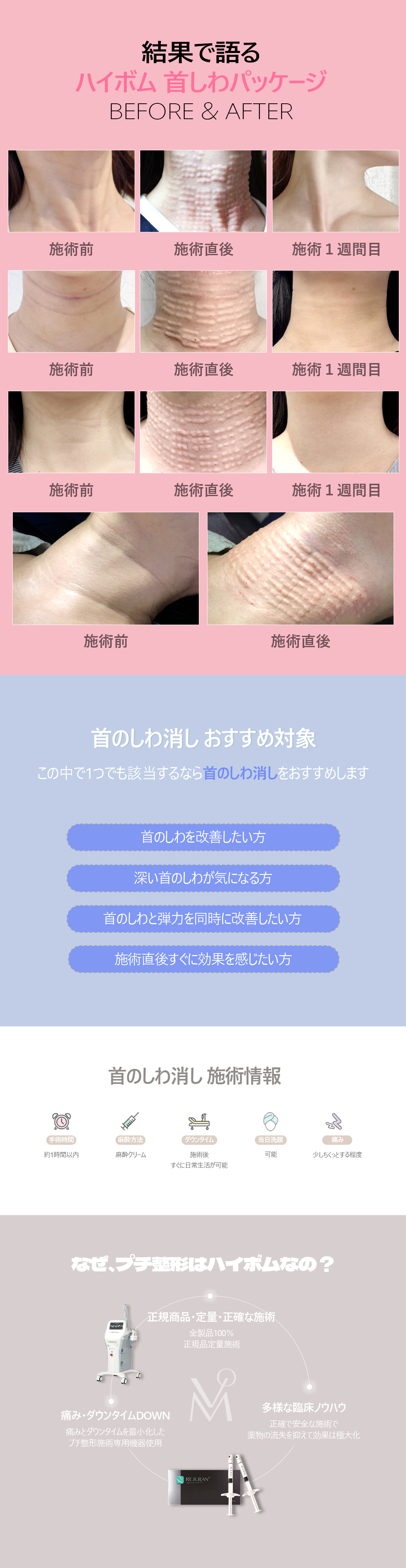 Cải thiện nếp nhăn cổ｜Hướng đến vùng cổ tươi trẻ bằng liệu trình Virtue RF x Rejuran｜Phòng khám Thẩm mỹ Ngoại khoa Highbeom Seoul