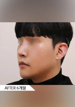 After