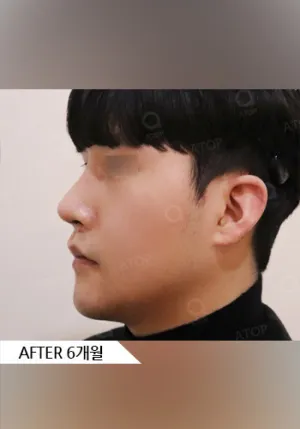 After