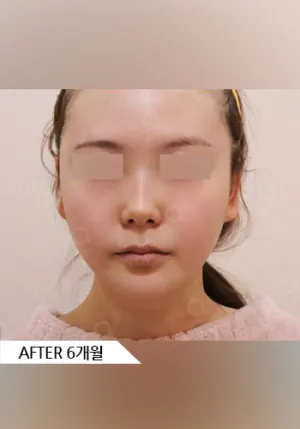 After