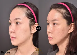 After