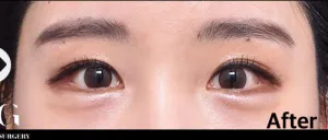 After