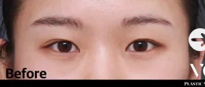 Before