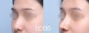 Before