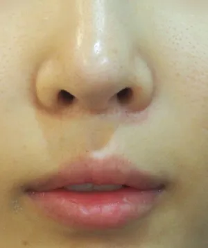 After