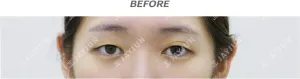 Before