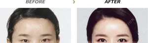 Before