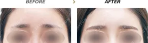Before