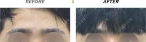 Before