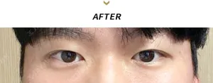 After