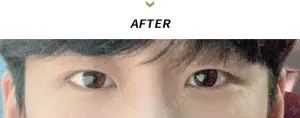 After