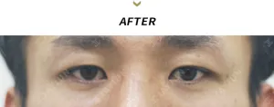After