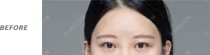 Before