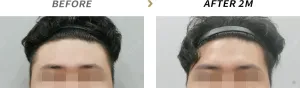 Before