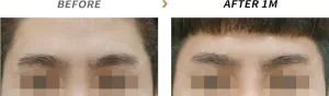 Before