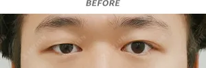 Before