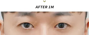 After