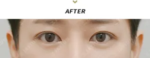 After