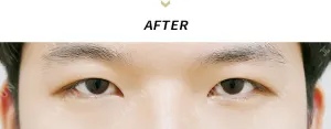 After